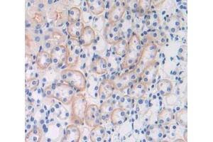 Used in DAB staining on fromalin fixed paraffin- embedded Kidney tissue (SRPRB 抗体  (AA 56-269))