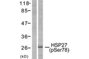 Western blot analysis of extracts from HeLa cells treated with Ca2+, using HSP27 (Phospho-Ser78) Antibody. (HSP27 抗体  (pSer78))