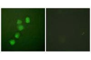 Immunofluorescence analysis of HuvEc cells, using Cyclin E1 (Ab-395) antibody. (Cyclin E1 抗体  (Thr395))