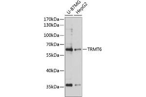 Western blot analysis of extracts of various cell lines, using TRMT6 antibody (ABIN6133079, ABIN6149556, ABIN6149557 and ABIN6224931) at 1:3000 dilution. (TRMT6 抗体  (AA 1-200))