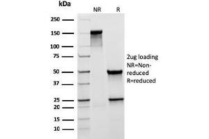 SDS-PAGE Analysis Purified MUC5AC Recombinant Mouse Monoclonal Antibody (rMUC5AC/3779). (Recombinant MUC5AC 抗体)