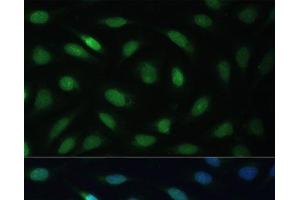 Immunofluorescence analysis of U-2 OS cells using LBR Polyclonal Antibody at dilution of 1:100 (40x lens). (Lamin B Receptor 抗体)