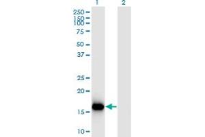 Western Blot analysis of BATF3 expression in transfected 293T cell line by BATF3 monoclonal antibody (M04), clone 3H1.