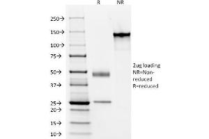 SDS-PAGE Analysis Purified Cytokeratin, LMW Monoclonal Antibody (AE-1). (Keratin 77 抗体)