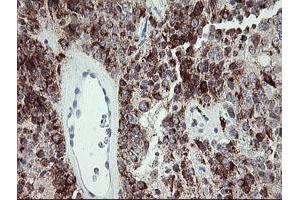 Image no. 2 for anti-Cyclin-Dependent Kinase Inhibitor 2B (p15, Inhibits CDK4) (CDKN2B) antibody (ABIN1497444) (CDKN2B 抗体)