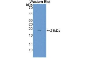 Western Blotting (WB) image for anti-Regenerating Islet-Derived 1 beta (REG1B) (AA 23-166) antibody (ABIN1870282) (REG1B 抗体  (AA 23-166))