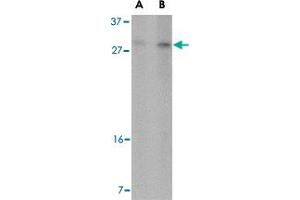 Western blot analysis of DDIT4 in 293 cell lysate with DDIT4 polyclonal antibody  at (A) 2 and (B) 4 ug/mL . (DDIT4 抗体  (Internal Region))