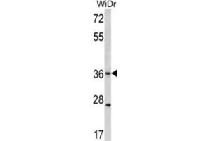 Western Blotting (WB) image for anti-Gap Junction Protein, beta 3, 31kDa (GJB3) antibody (ABIN2998428)