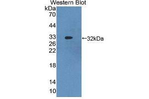 Western Blotting (WB) image for anti-ATP-Binding Cassette, Sub-Family B (MDR/TAP), Member 8 (ABCB8) (AA 472-735) antibody (ABIN5013189)