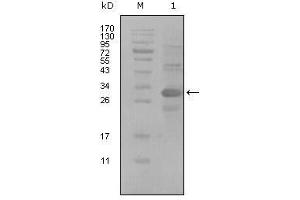Western blot analysis using ALCAM mouse mAb against truncated Trx-ALCAM recombinant protein (1). (CD166 抗体  (AA 405-524))