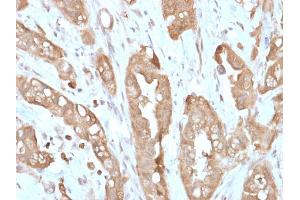 Formalin-fixed, paraffin-embedded human Small Intestine stained with Villin Rabbit Recombinant Monoclonal Antibody (VIL1/2310R). (Recombinant Villin 1 抗体  (AA 179-311))