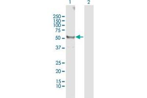 Western Blotting (WB) image for anti-Tubulin, beta 1 (TUBB1) (AA 1-451) antibody (ABIN950104)
