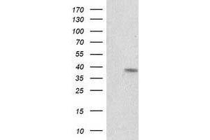 Western Blotting (WB) image for anti-Retinol Dehydrogenase 14 (All-Trans/9-Cis/11-Cis) (RDH14) antibody (ABIN1500657)