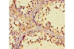 Immunohistochemistry of paraffin-embedded human testis tissue using ABIN7176469 at dilution of 1:100 (ZNF662 抗体  (AA 182-452))