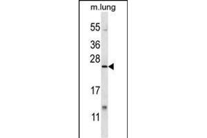 XBP1 Antibody (C-term) (ABIN656725 and ABIN2845950) western blot analysis in mouse lung tissue lysates (35 μg/lane). (XBP1 抗体  (C-Term))