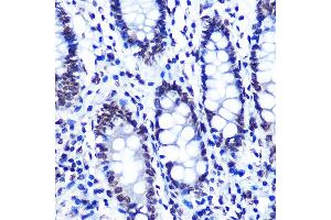Immunohistochemistry of paraffin-embedded human colon using Phospho-SMC1-S957 Rabbit mAb (ABIN7270613) at dilution of 1:100 (40x lens). (SMC1A 抗体  (pSer957))