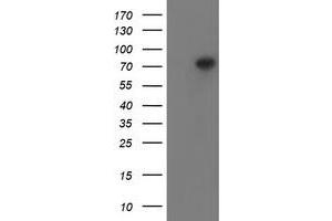 Western Blotting (WB) image for anti-Peptidyl Arginine Deiminase, Type IV (PADI4) antibody (ABIN1500017)