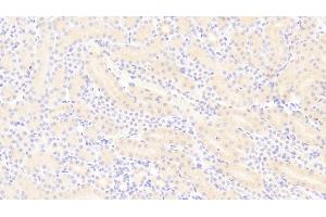 Detection of PDGF BB in Mouse Kidney Tissue using Polyclonal Antibody to Platelet Derived Growth Factor BB (PDGF BB) (PDGF-BB Homodimer (AA 21-241) 抗体)
