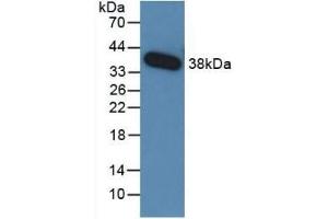 Detection of Recombinant TGFb3, Human using Monoclonal Antibody to Transforming Growth Factor Beta 3 (TGFb3) (TGFB3 抗体  (AA 24-300))