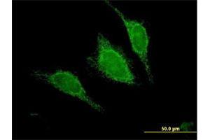 Immunofluorescence of purified MaxPab antibody to ACADM on HeLa cell. (Medium-Chain Specific Acyl-CoA Dehydrogenase, Mitochondrial (AA 1-421) 抗体)