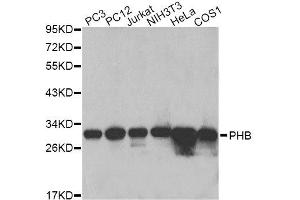 Western blot analysis of extracts of various cell lines, using PHB antibody. (Prohibitin 抗体  (AA 73-272))