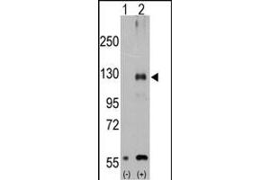 Western blot analysis of TR (arrow) using rabbit polyclonal TR Antibody (Center ) (ABIN392820 and ABIN2842252). (TRPM8 抗体  (AA 521-552))