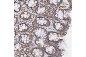 Immunohistochemical staining of human rectum with RNF213 polyclonal antibody  shows moderate cytoplasmic positivity in glandular cells at 1:200-1:500 dilution. (RNF213 抗体)