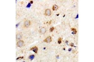 Immunohistochemical analysis of MYPT1 staining in human brain formalin fixed paraffin embedded tissue section.