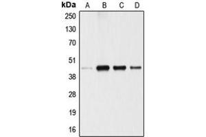Western blot analysis of ANGPTL4 expression in A549 (A), 293T (B), U87MG (C), SGC (D) whole cell lysates. (ANGPTL4 抗体  (Center))
