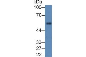 Detection of a1AT in Rat Pancreas lysate using Polyclonal Antibody to Alpha-1-Antitrypsin (a1AT) (SERPINA1 抗体  (AA 27-181))