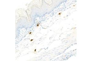 Immunohistochemistry analysis of paraffin-embedded mouseskinusing Chymase (ABIN7073506) at dilution of 1:1000 (CMA1 抗体)