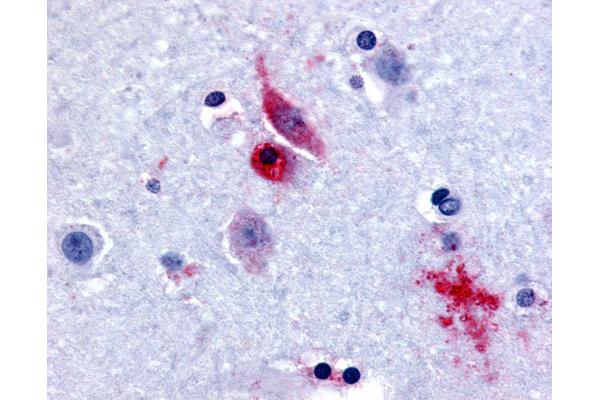 GPR61 抗体  (Extracellular Domain)