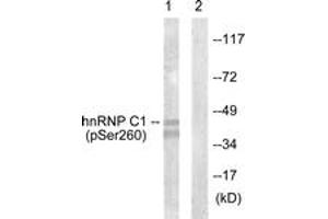 Western blot analysis of extracts from 293 cells treated with H2O2 100uM 15', using hnRNP C1/2 (Phospho-Ser260) Antibody. (HNRNPC 抗体  (pSer260))
