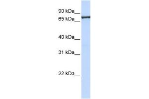WB Suggested Anti-TNPO2 Antibody Titration: 0. (TNPO2 抗体  (C-Term))