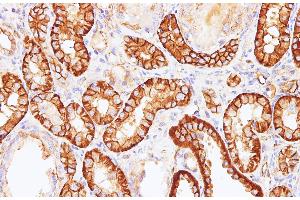 Immunohistochemistry (Paraffin-embedded Sections) (IHC (p)) image for anti-Spectrin alpha Chain, Brain (SPTAN1) antibody (ABIN7234066)