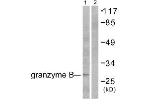 Western blot analysis of extracts from NIH/3T3 cells, using Granzyme B antibody (ABIN2843546). (GZMB 抗体  (N-Term))