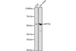 Western blot analysis of extracts of various cell lines, using (ABIN6130229, ABIN6143029, ABIN6143030 and ABIN6217868) at 1:1000 dilution. (Keratin 36 抗体  (AA 388-467))