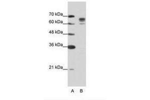Image no. 2 for anti-DEAD (Asp-Glu-Ala-Asp) Box Polypeptide 17 (DDX17) (AA 570-619) antibody (ABIN203205) (DDX17 抗体  (AA 570-619))