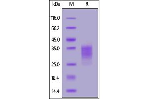 Biotinylated Human CD79B, His,Avitag on  under reducing (R) condition.