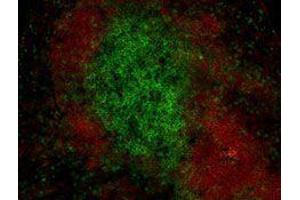 Immunofluorescence (IF) image for anti-CD19 Molecule (CD19) antibody (Alexa Fluor 594) (ABIN2656821) (CD19 抗体  (Alexa Fluor 594))