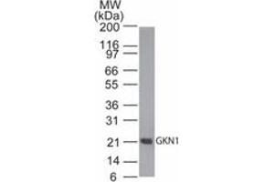 Image no. 1 for anti-Gastrokine 1 (GKN1) (AA 100-150) antibody (ABIN960186) (Gastrokine 1 抗体  (AA 100-150))