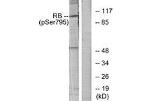 Western blot analysis of extracts from K562 cells treated with serum 10%, using Retinoblastoma (Phospho-Ser795) Antibody. (Retinoblastoma Protein (Rb) 抗体  (pSer795))