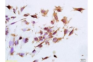 Formalin-fixed and paraffin embedded human epithelial cells tissue labeled with Anti-CK14 Polyclonal Antibody, Unconjugated at 1:300 followed by conjugation to the secondary antibody, (SP-0023), and DAB staining (pan Keratin 抗体)