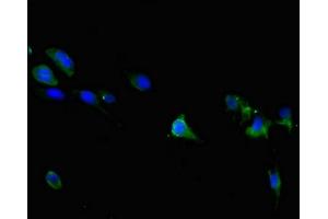 Immunofluorescent analysis of 293 cells using ABIN7172868 at dilution of 1:100 and Alexa Fluor 488-congugated AffiniPure Goat Anti-Rabbit IgG(H+L) (TRPM6 抗体  (AA 740-840))