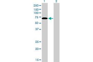 Western Blot analysis of CARF expression in transfected 293T cell line by CARF monoclonal antibody (M06), clone 1F7.
