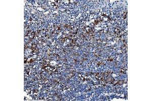IHC analysis of Liver Carboxylesterase 1/CES1 using anti-Liver Carboxylesterase 1/CES1 antibody (ABIN7602719).