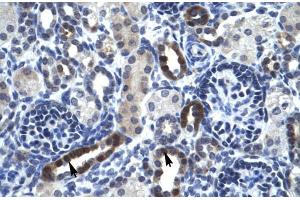 Human kidney; TSFM antibody - N-terminal region in Human kidney cells using Immunohistochemistry (TSFM 抗体  (N-Term))