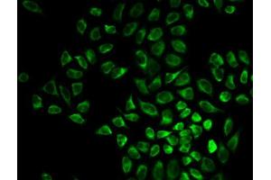Immunofluorescence (IF) image for anti-Vimentin (VIM) (AA 1-200) antibody (ABIN3016292) (Vimentin 抗体  (AA 1-200))