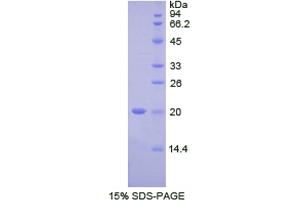 SDS-PAGE analysis of Human FcgBP Protein. (FCGBP 蛋白)