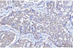 IHC analysis of C18orf22/RBFA using anti-C18orf22/RBFA antibody (ABIN7600106).